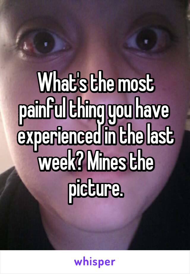 What's the most painful thing you have  experienced in the last week? Mines the picture.