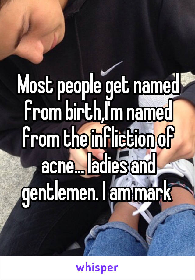 Most people get named from birth,I'm named from the infliction of acne... ladies and gentlemen. I am mark 