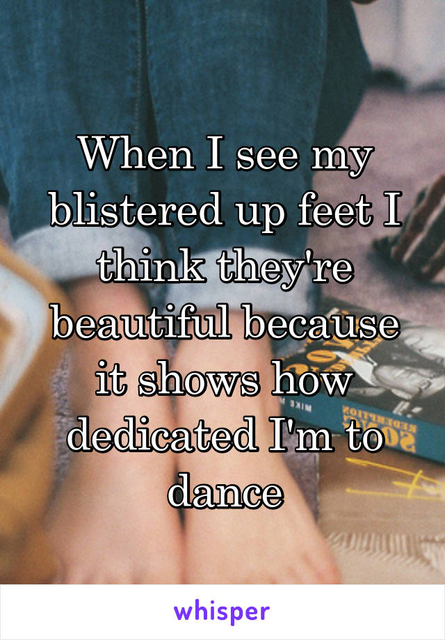 When I see my blistered up feet I think they're beautiful because it shows how dedicated I'm to dance