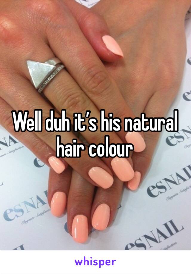 Well duh it’s his natural hair colour