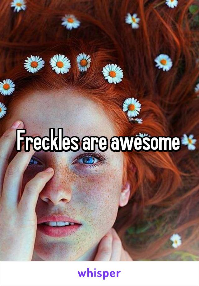 Freckles are awesome 
