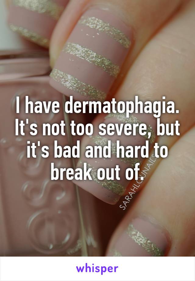 I have dermatophagia. It's not too severe, but it's bad and hard to break out of.