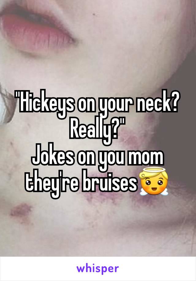 "Hickeys on your neck? Really?"
Jokes on you mom they're bruises😇