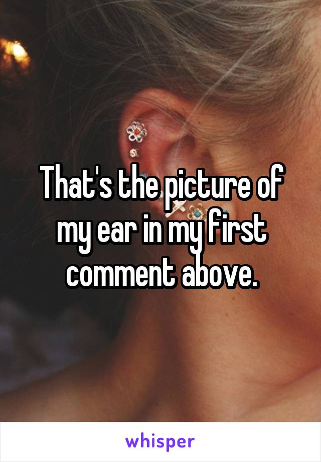 That's the picture of my ear in my first comment above.