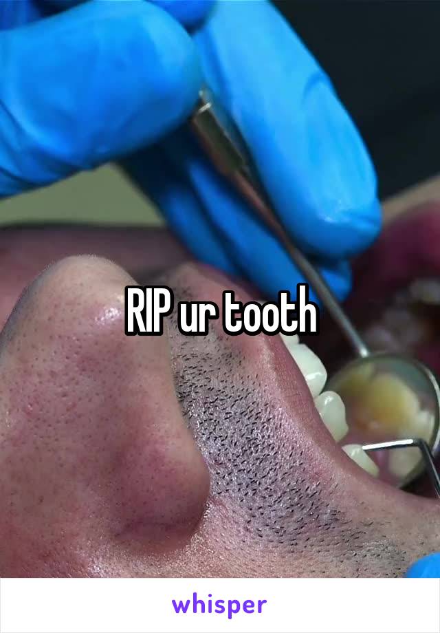 RIP ur tooth