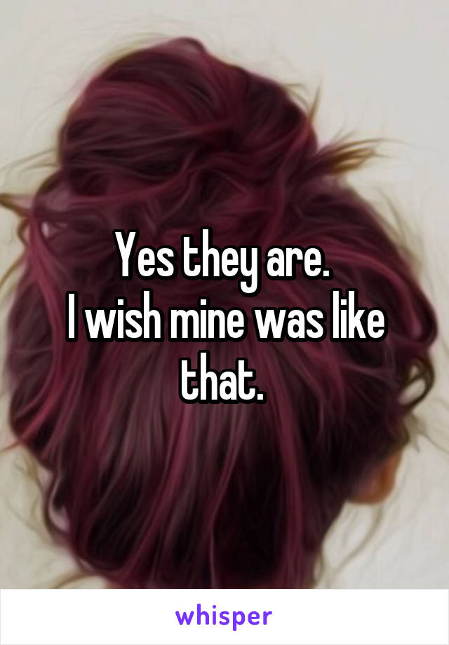 Yes they are. 
I wish mine was like that. 