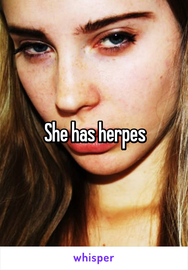 She has herpes