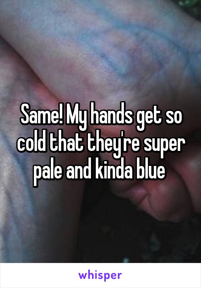 Same! My hands get so cold that they're super pale and kinda blue 