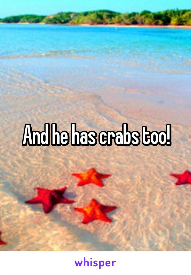 And he has crabs too!