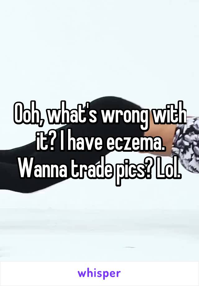 Ooh, what's wrong with it? I have eczema. Wanna trade pics? Lol. 