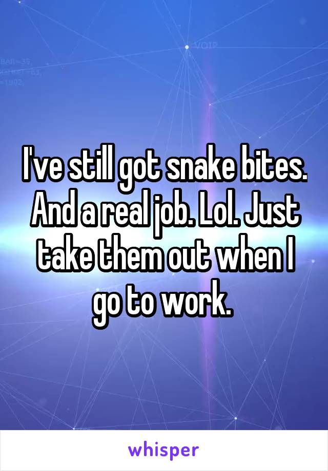 I've still got snake bites. And a real job. Lol. Just take them out when I go to work. 