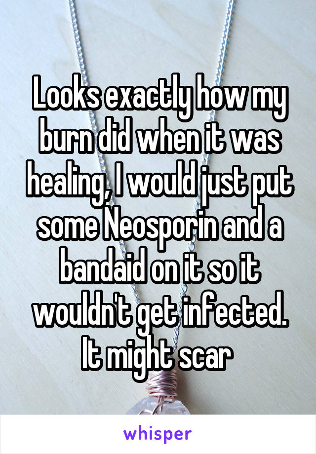 Looks exactly how my burn did when it was healing, I would just put some Neosporin and a bandaid on it so it wouldn't get infected. It might scar 