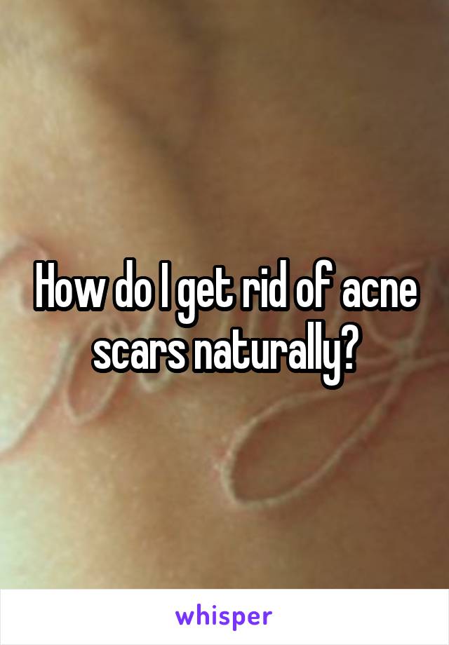 How do I get rid of acne scars naturally?