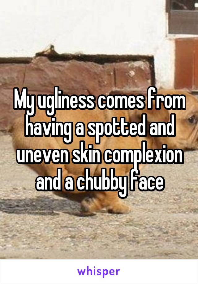 My ugliness comes from having a spotted and uneven skin complexion and a chubby face