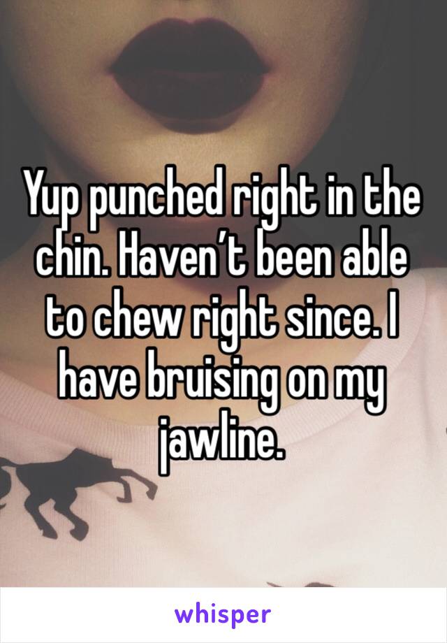 Yup punched right in the chin. Haven’t been able to chew right since. I have bruising on my jawline. 