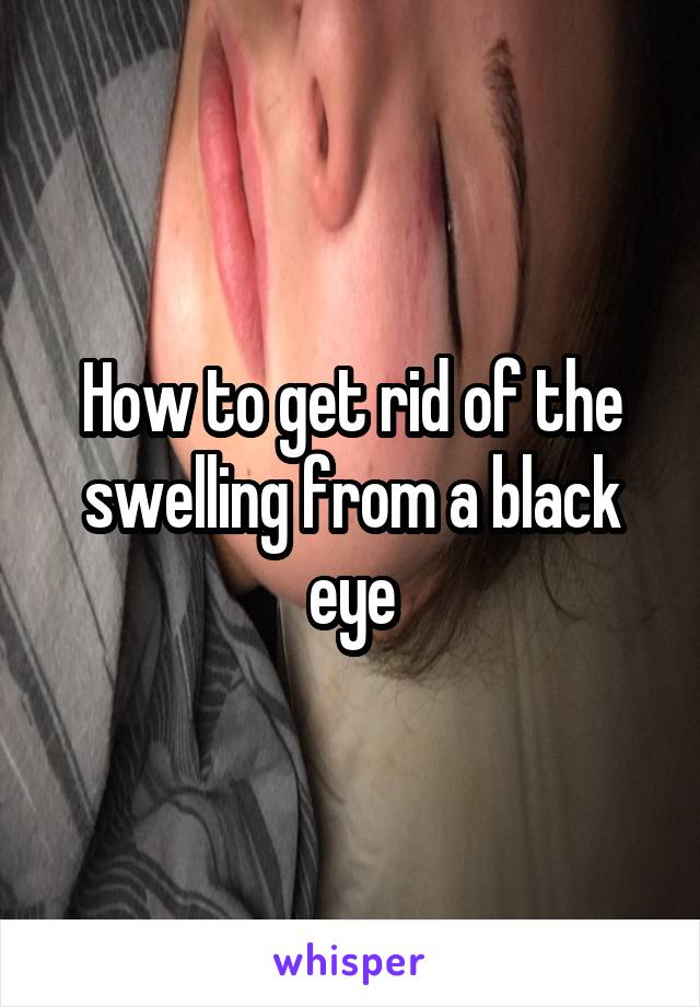 How to get rid of the swelling from a black eye