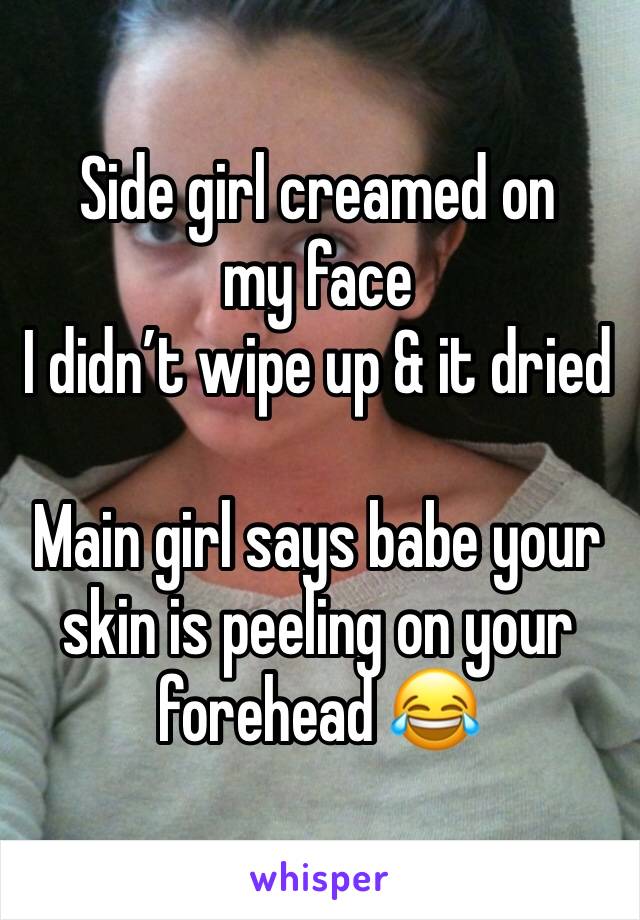 Side girl creamed on my face
I didn’t wipe up & it dried

Main girl says babe your skin is peeling on your forehead 😂