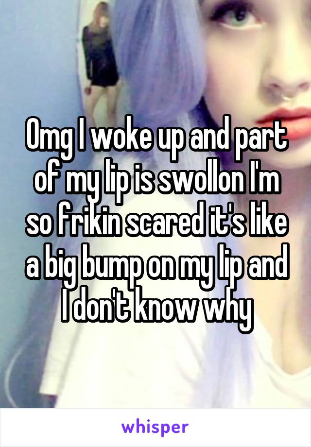 Omg I woke up and part of my lip is swollon I'm so frikin scared it's like a big bump on my lip and I don't know why