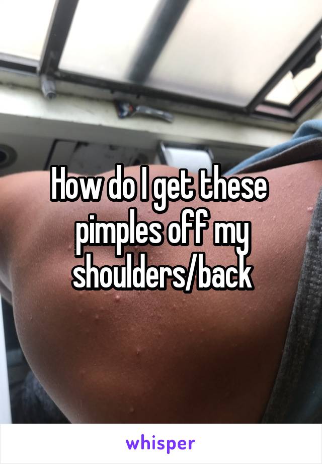 How do I get these  pimples off my shoulders/back