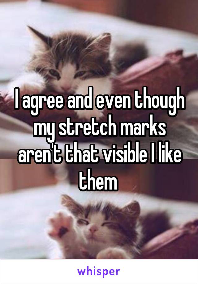 I agree and even though my stretch marks aren't that visible I like them 