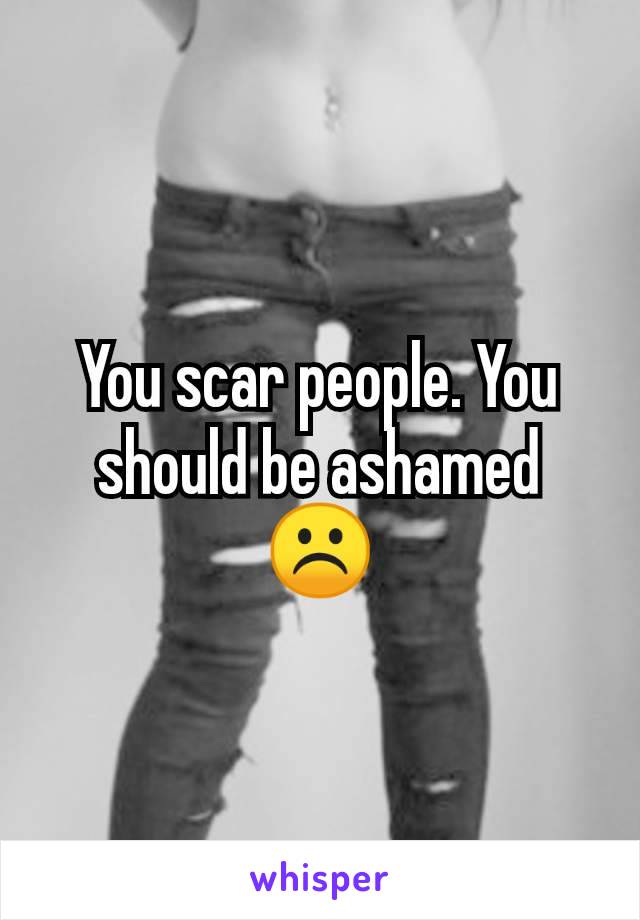 You scar people. You should be ashamed ☹️