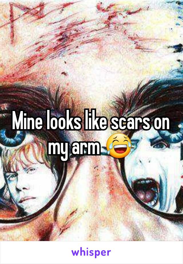 Mine looks like scars on my arm 😂