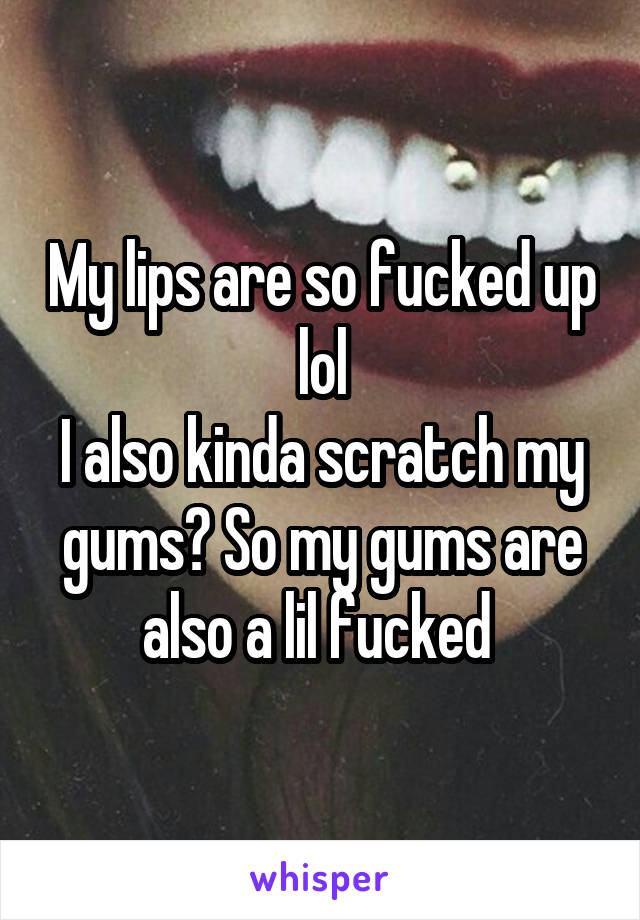 My lips are so fucked up lol
I also kinda scratch my gums? So my gums are also a lil fucked 