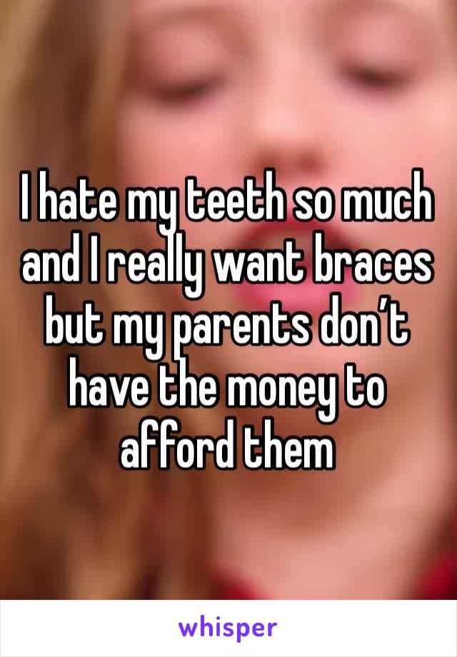 I hate my teeth so much and I really want braces but my parents don’t have the money to afford them 