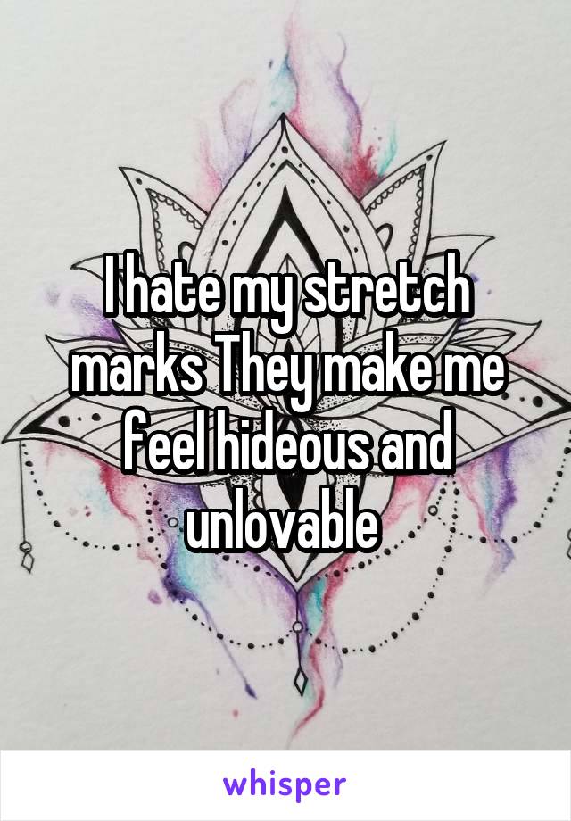 I hate my stretch marks They make me feel hideous and unlovable 