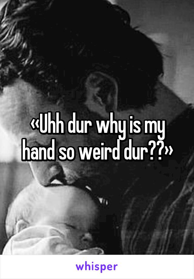 «Uhh dur why is my hand so weird dur??»