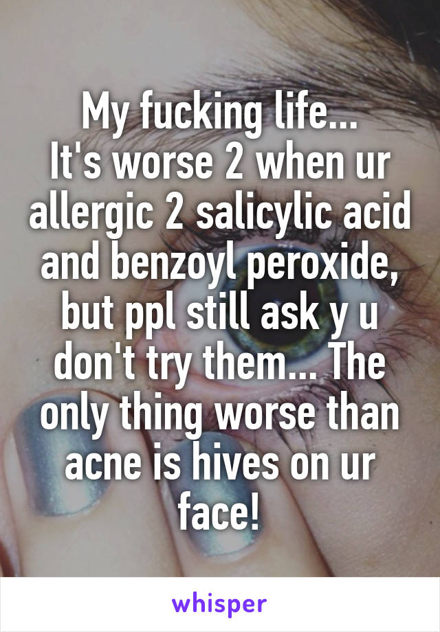 My fucking life...
It's worse 2 when ur allergic 2 salicylic acid and benzoyl peroxide, but ppl still ask y u don't try them... The only thing worse than acne is hives on ur face!