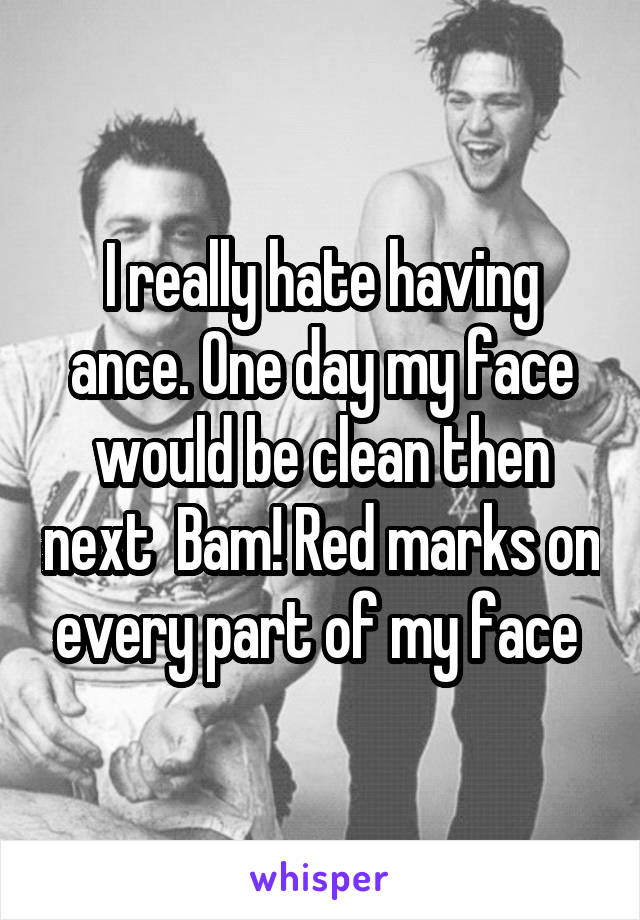 I really hate having ance. One day my face would be clean then next  Bam! Red marks on every part of my face 