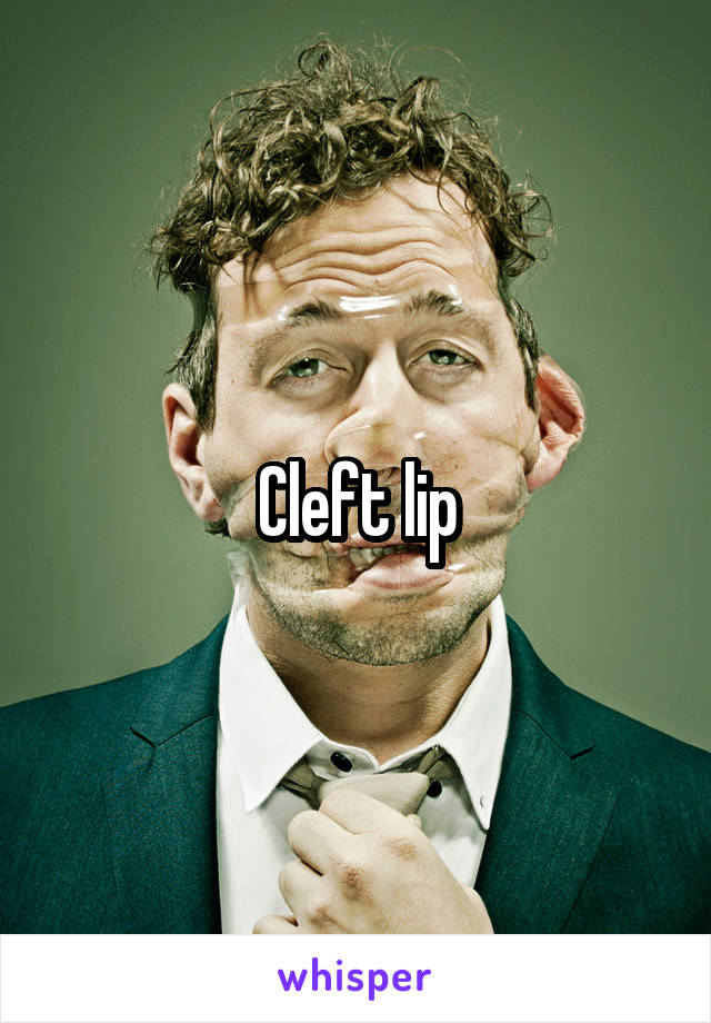 Cleft lip