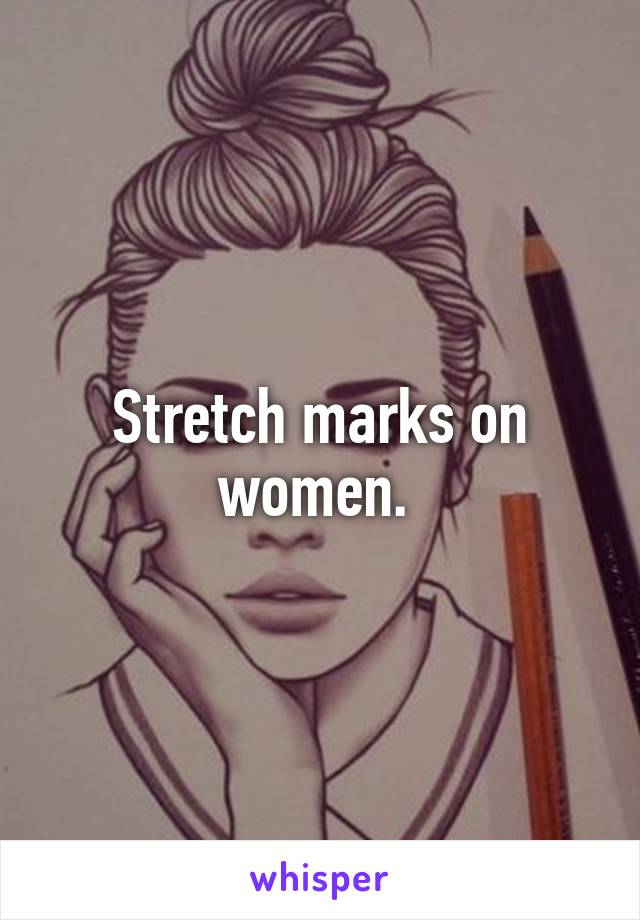 Stretch marks on women. 