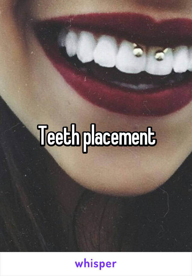 Teeth placement