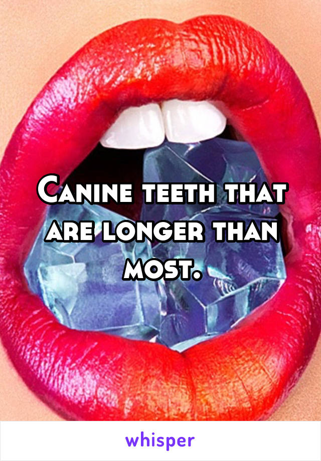 Canine teeth that are longer than most.