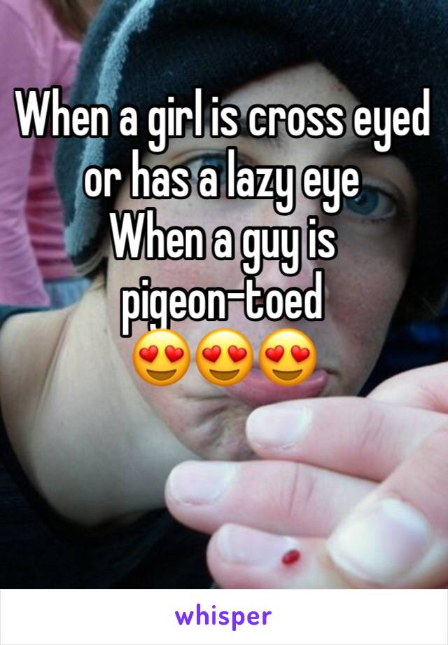 When a girl is cross eyed or has a lazy eye  
When a guy is pigeon-toed
😍😍😍