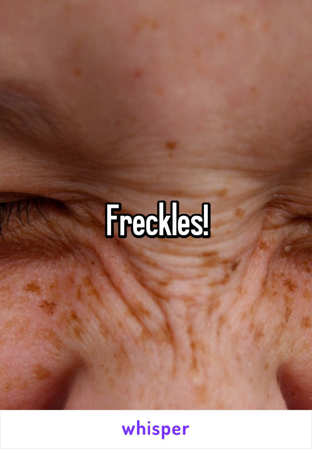 Freckles!