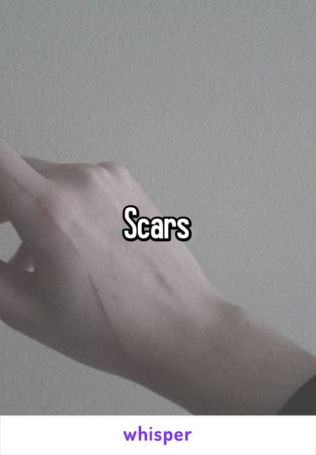 Scars 