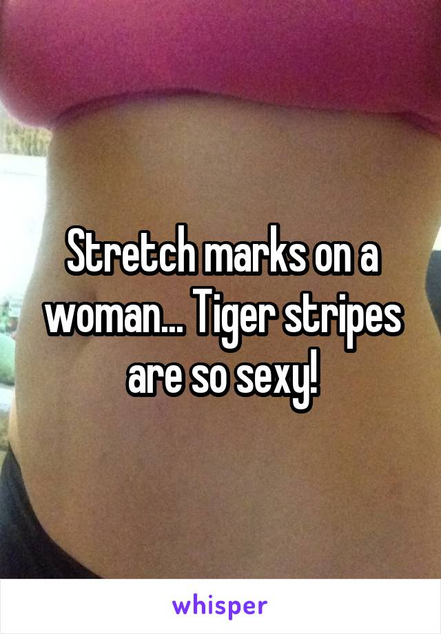 Stretch marks on a woman... Tiger stripes are so sexy!