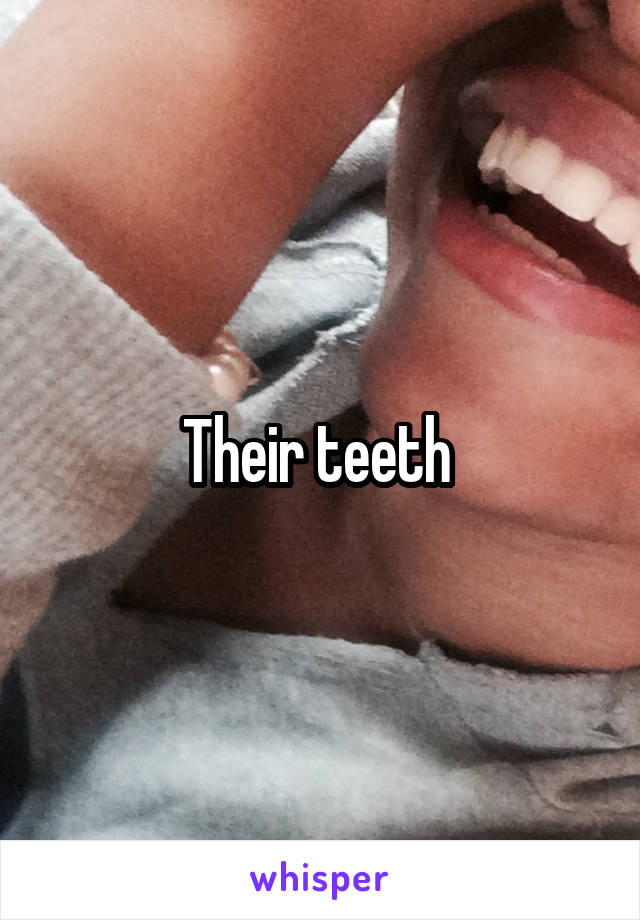 Their teeth 