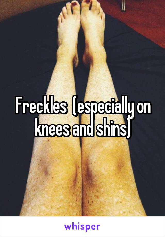 Freckles  (especially on knees and shins)