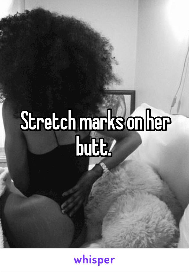 Stretch marks on her butt. 