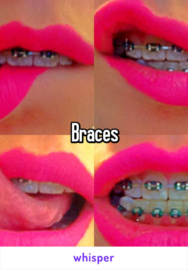 Braces