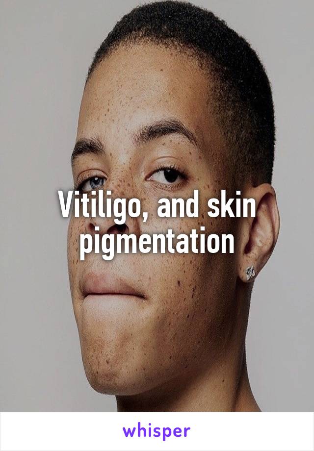 Vitiligo, and skin pigmentation