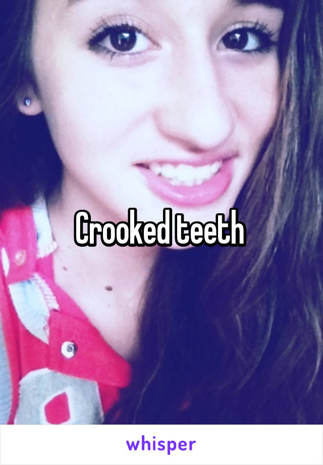 Crooked teeth 