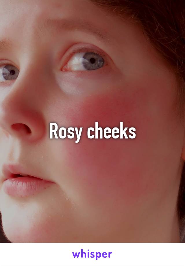 Rosy cheeks