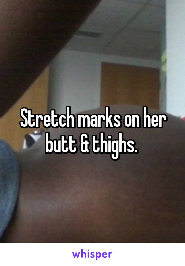 Stretch marks on her butt & thighs. 