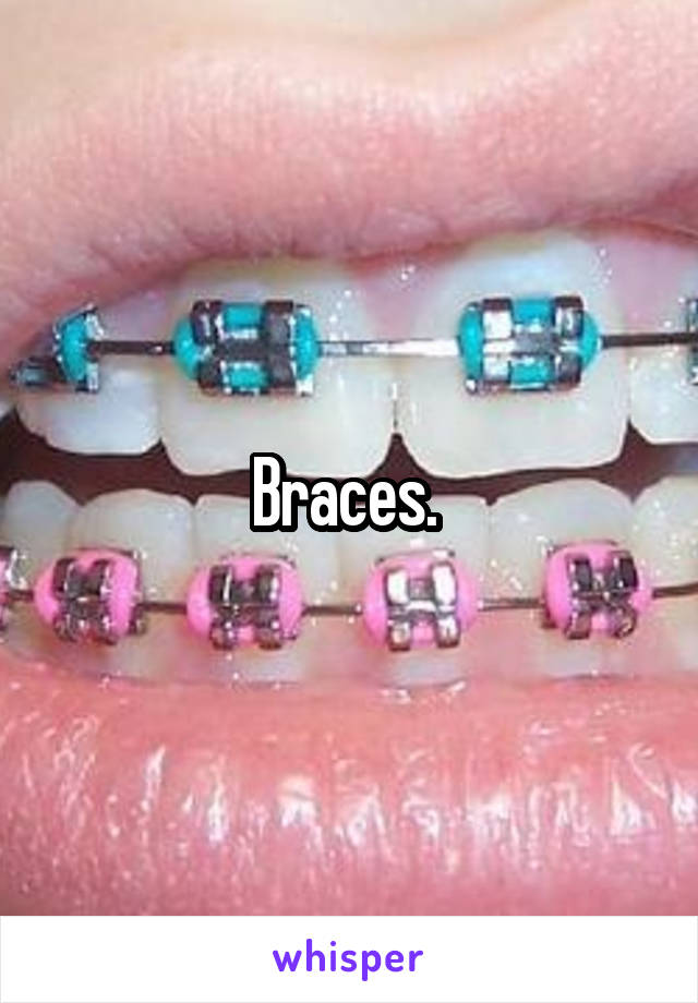 Braces. 