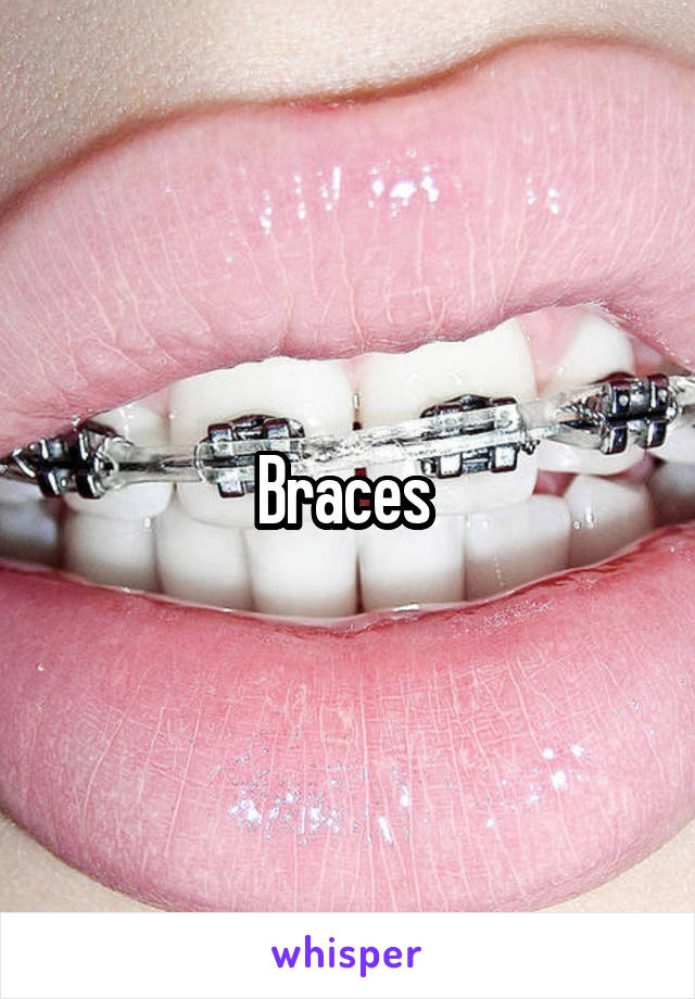Braces 